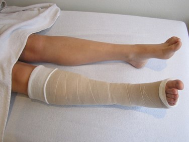 Oedeemtherapie 1